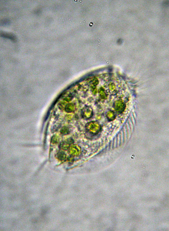 Tre Protozoi da identificare (se possibile)